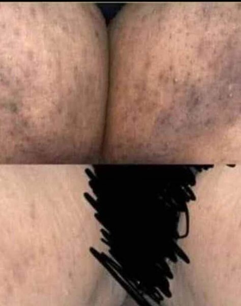 Crème entrejambe noire,