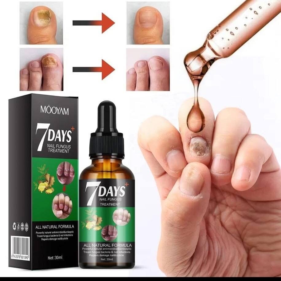 Traitement antifongique des ongles 7 Days