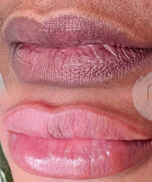 Lèvre rose