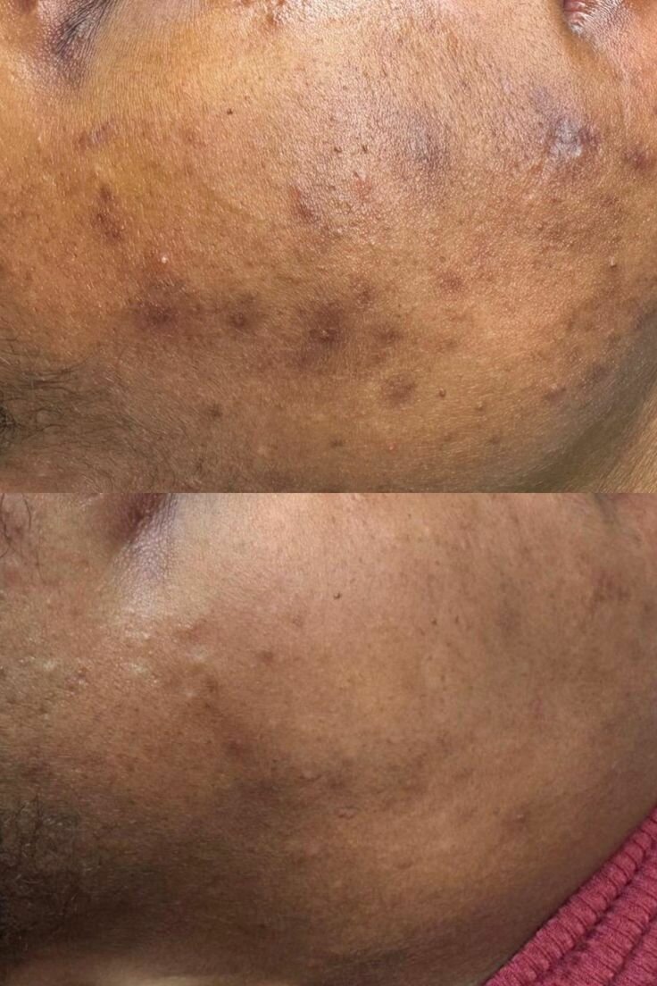 Savon Noir Africain Pur