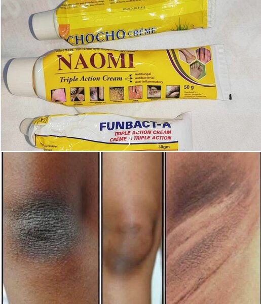 Triple action creams