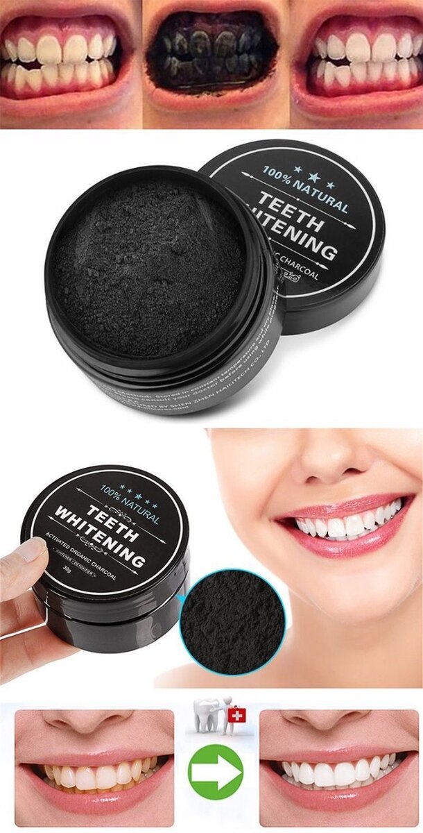 Charbon Actif Blanchiment Dentaire