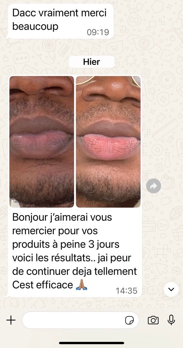 Kit Exfoliant Lèvres Kira Beauty