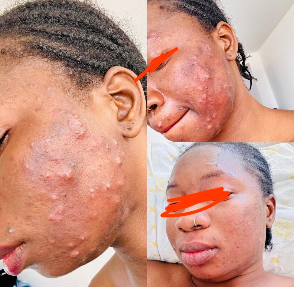 Savon facial ( visage )