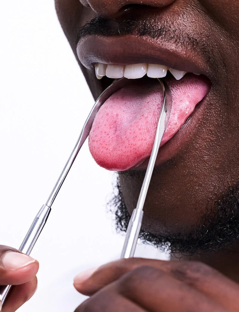 Tongue Scraper