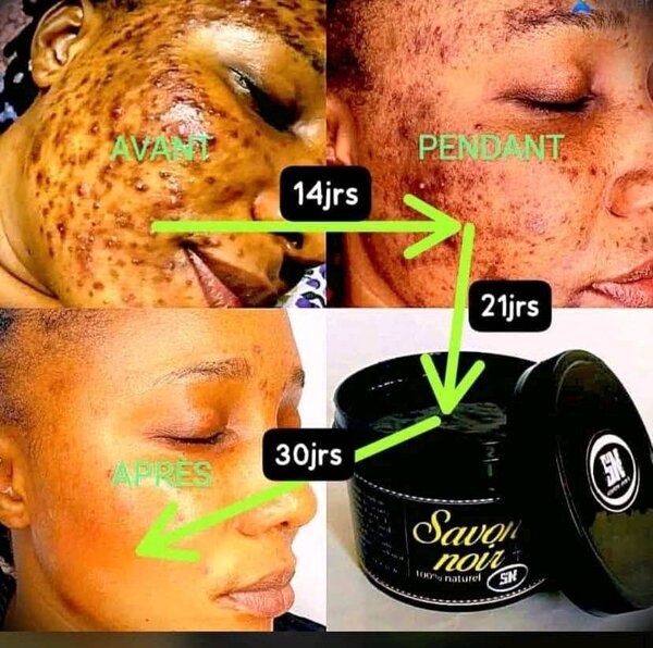 Savon Noir 100% Naturel