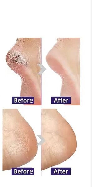 Exfoliating foot mask