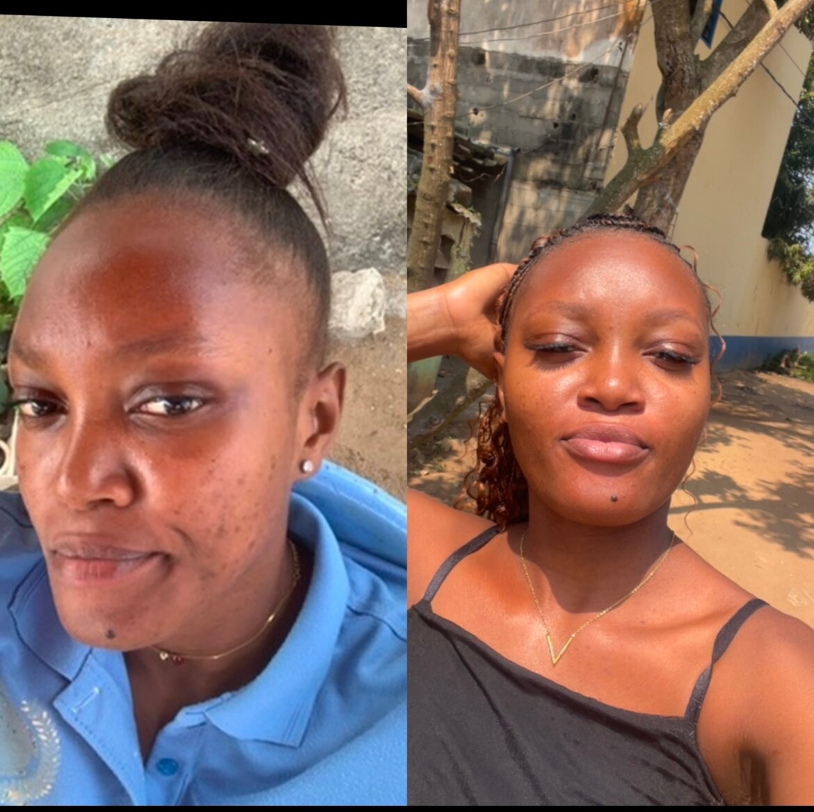 Savon clarifiant le visage