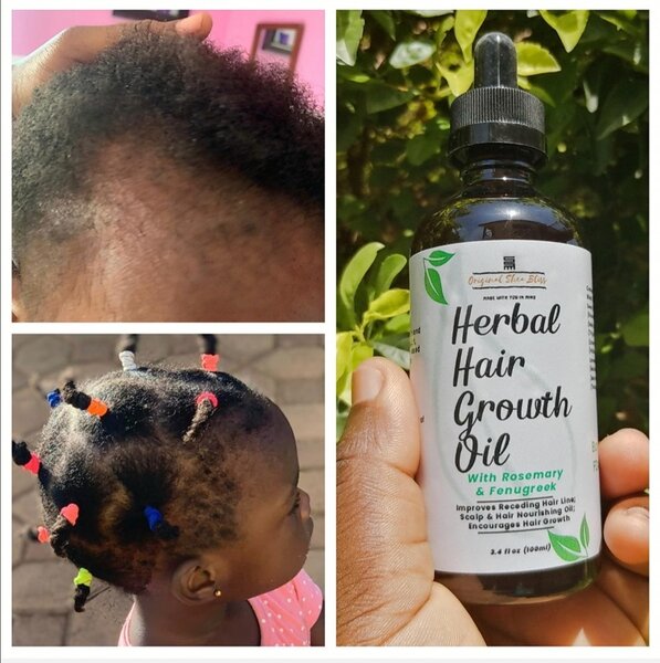 Herbal Hair Growth Oil