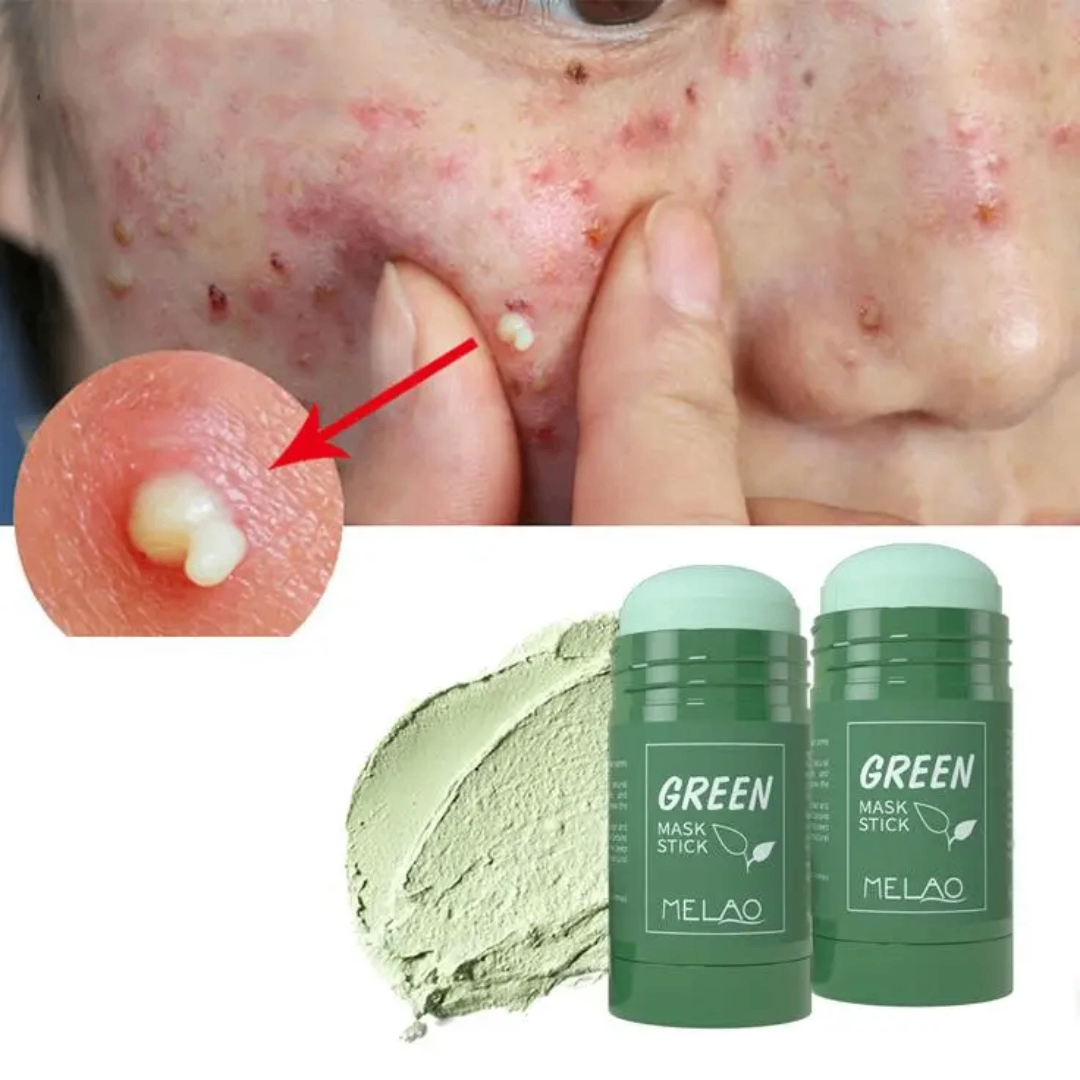 Masque Stick Green Anti-Acné