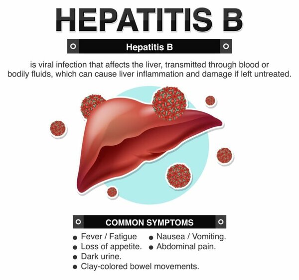Cure Hepatitis-B In 30 Days Naturally