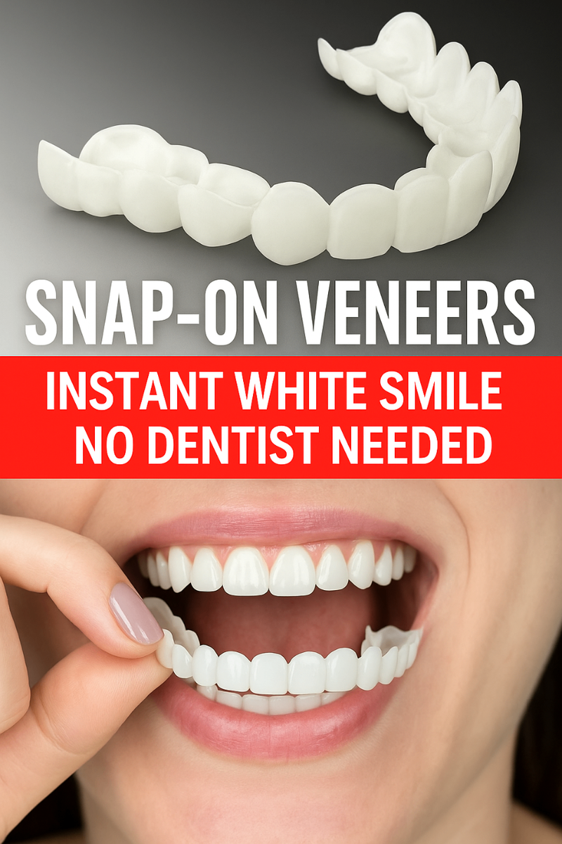 snap on custom veneers/ fake t