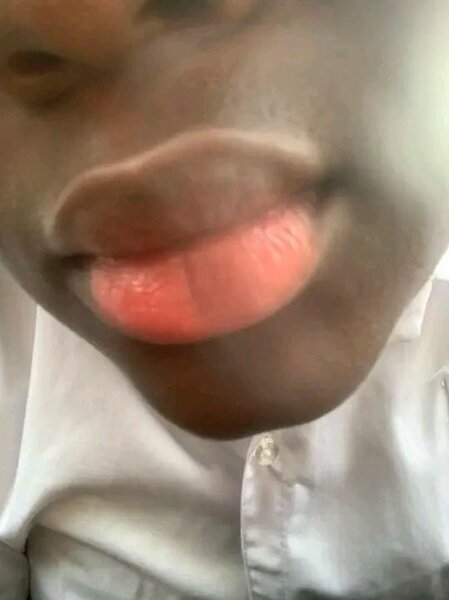 Élixir pour lèvres pulpeuses