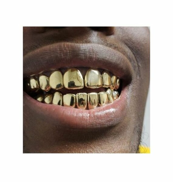 Dentier HipHop Or