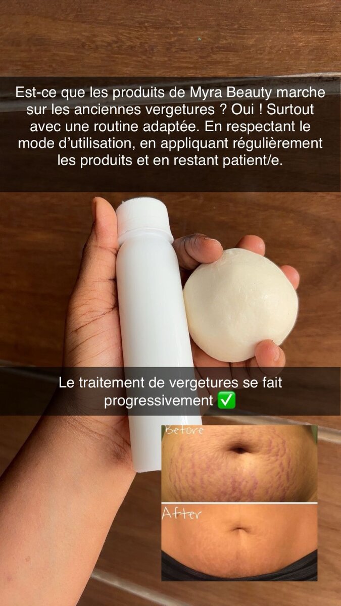 Kit Anti-Vergetures Myra Beauty