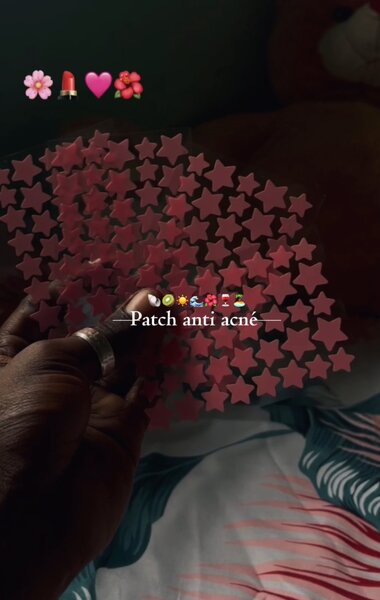 Patch ( 3 à 1000f )