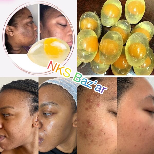 Dégraisse, élimine les taches,empêche lapparition des bouton