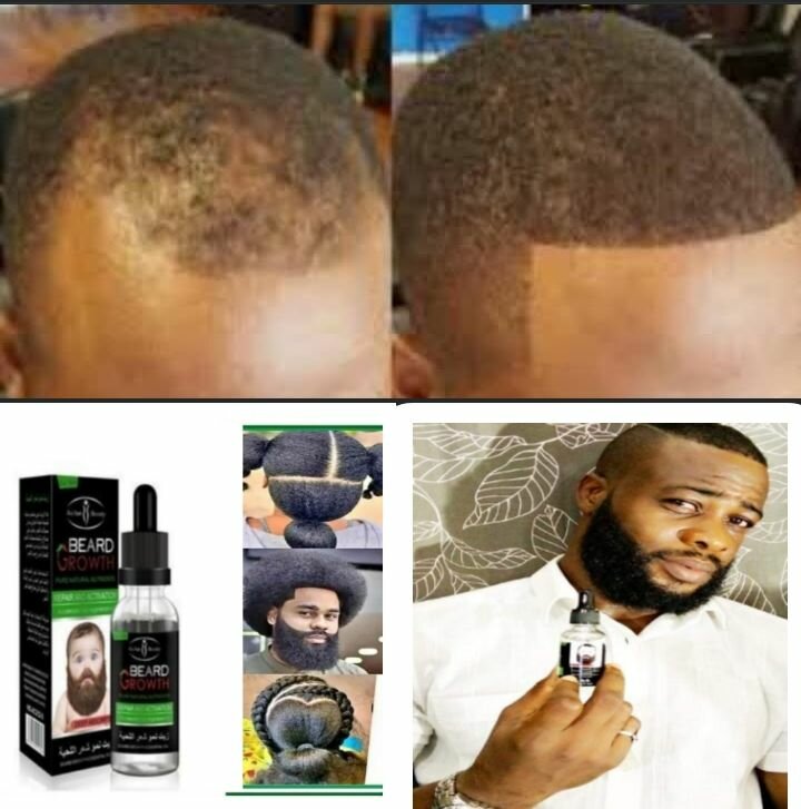 Ultras pousser barbe et cheveu