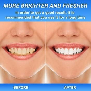 Pâte de blanchiment dentaire BodyAccel