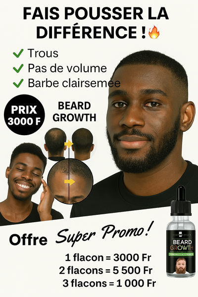 Fini avec la calvitie