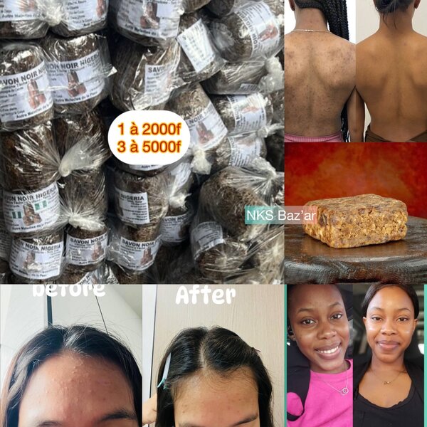 Nettoie les boutons , taches et gales