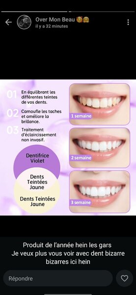Hismile v34 Dentifrice Blanchissant
