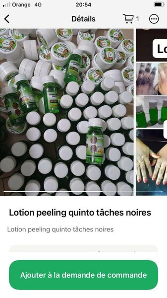 2 Lotions Peeling