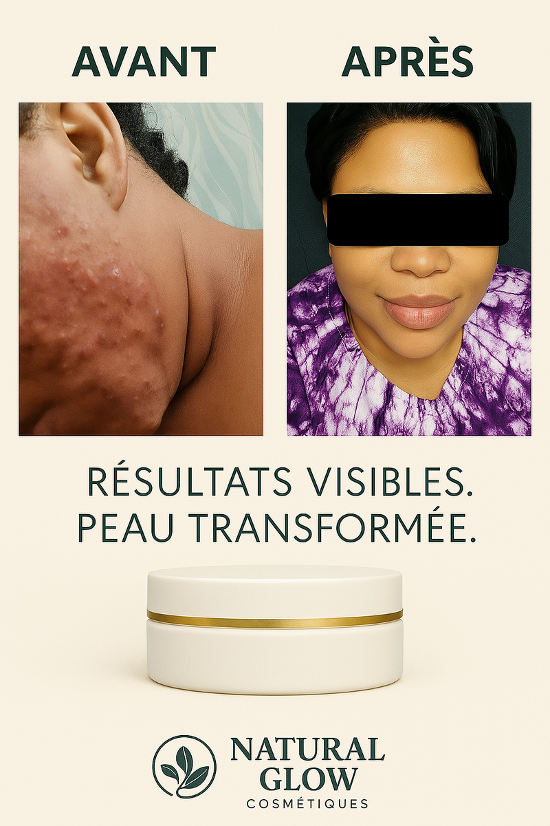 Kit Visage Anti-Acné et tâches