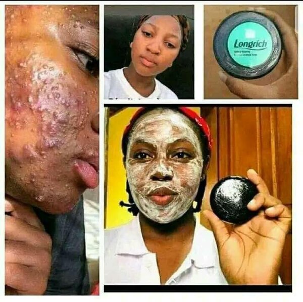 Savon Longrich Anti-Acné