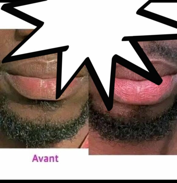 Baume à Lèvres Hydratant