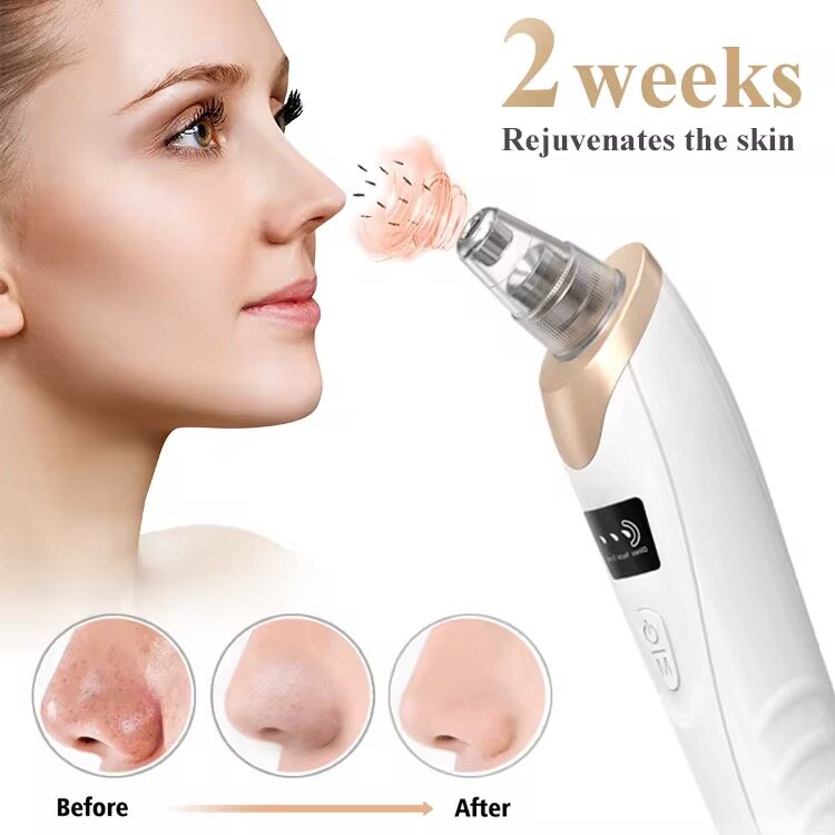 Aspirateur de points noirs - Épuration de la peau