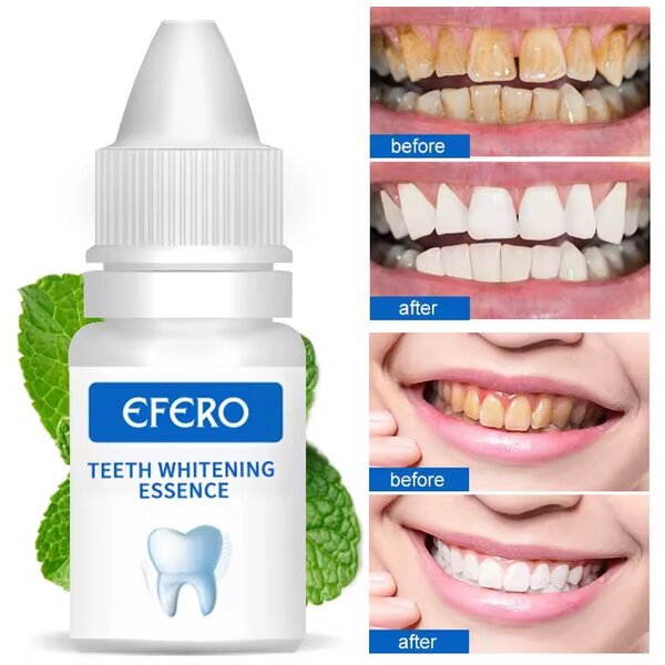 Teeth Whitening Gel