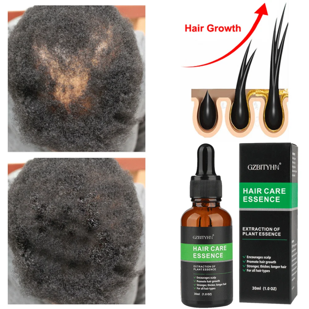 Essence de soin cheveux GZBTYHN