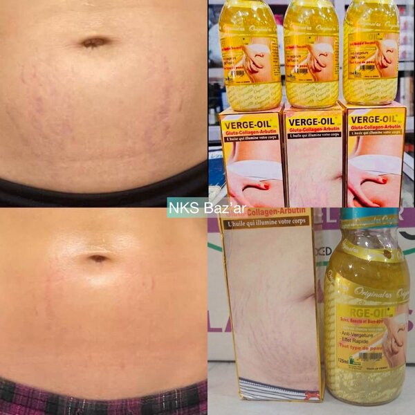 Élimine progressivement et complètement les vergetures