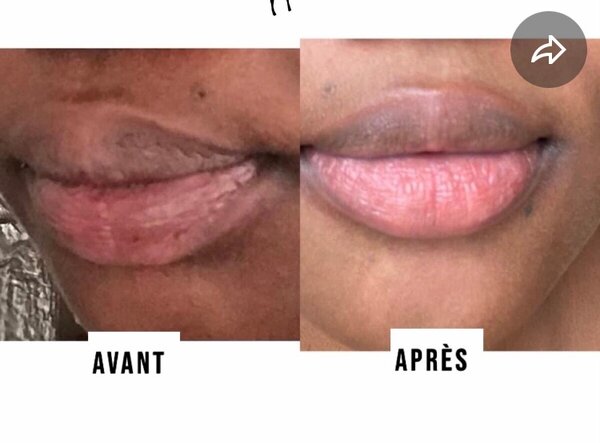 Baume à lèvres hydratant