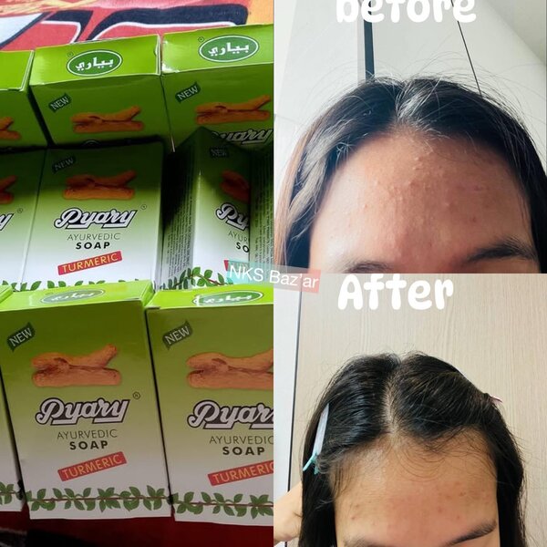 Traite l´acné, les mauvaises odeurs corporelles,rajeunit,