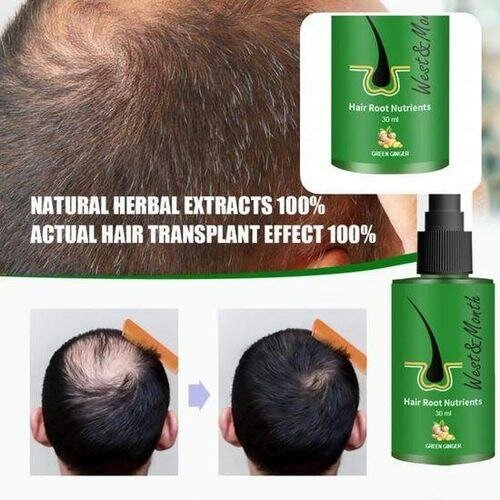 Dexe Lotion Anti-Chute Cheveux 120ml