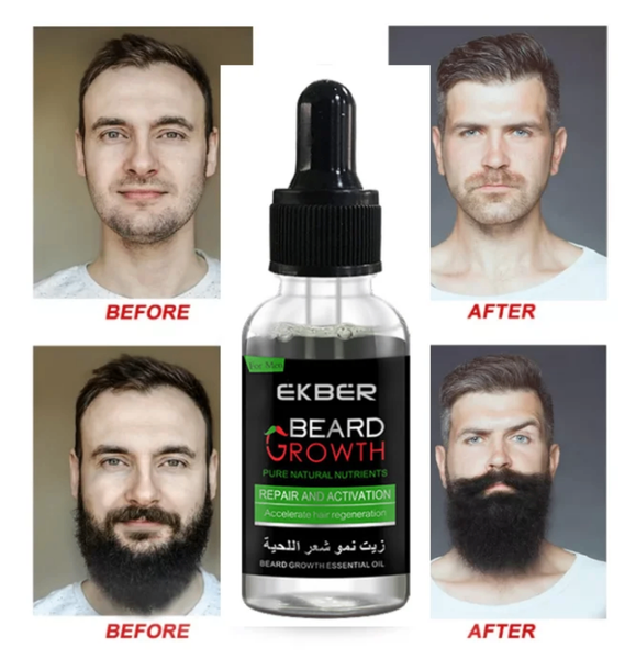 Huile Barbe Croissance Rapide