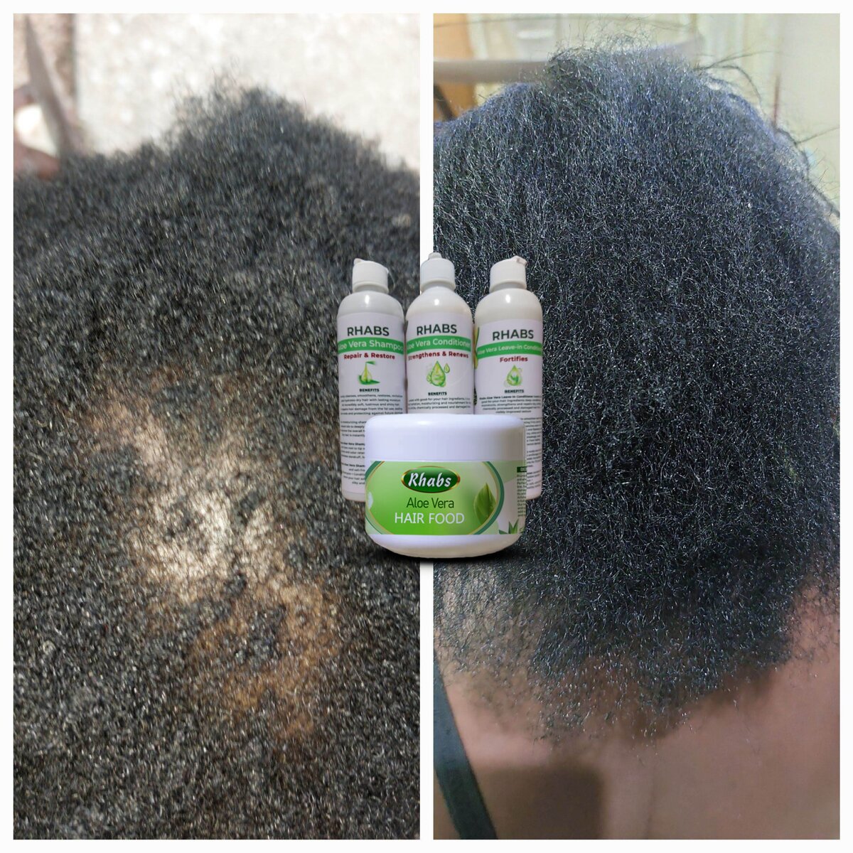 Rhabs Aloe Vera Hair Growth & Treatment Set