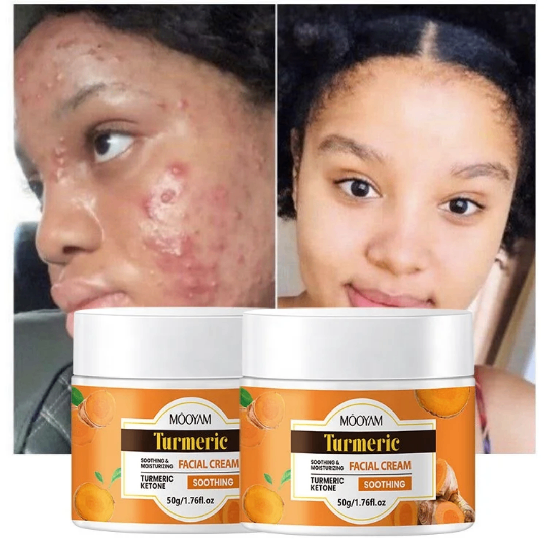 Crème Visage Apaisante Curcuma