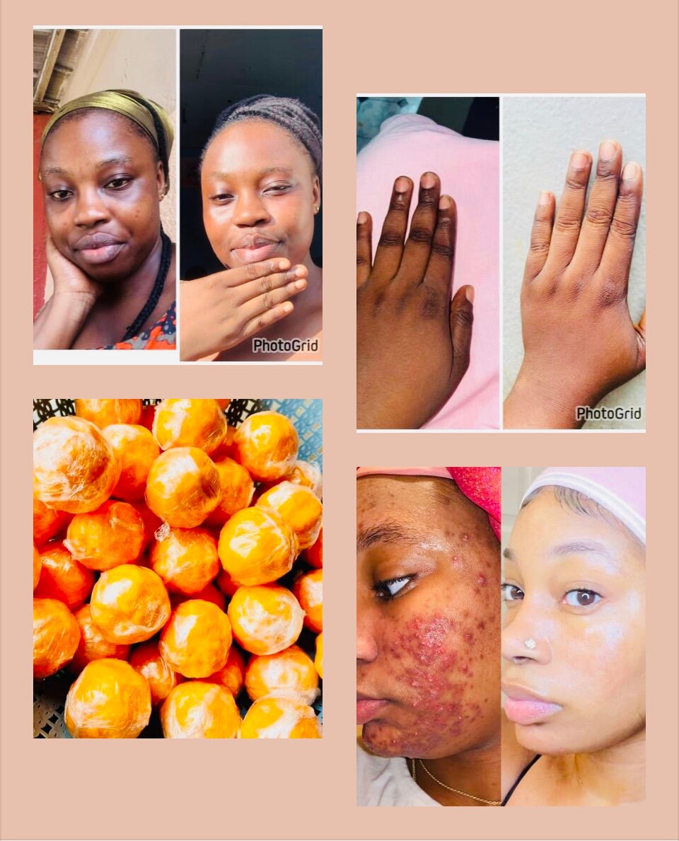 Savon facial ( visage )