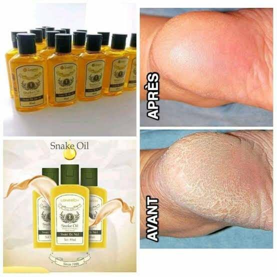 Huile de Serpent Cheveux et Peau