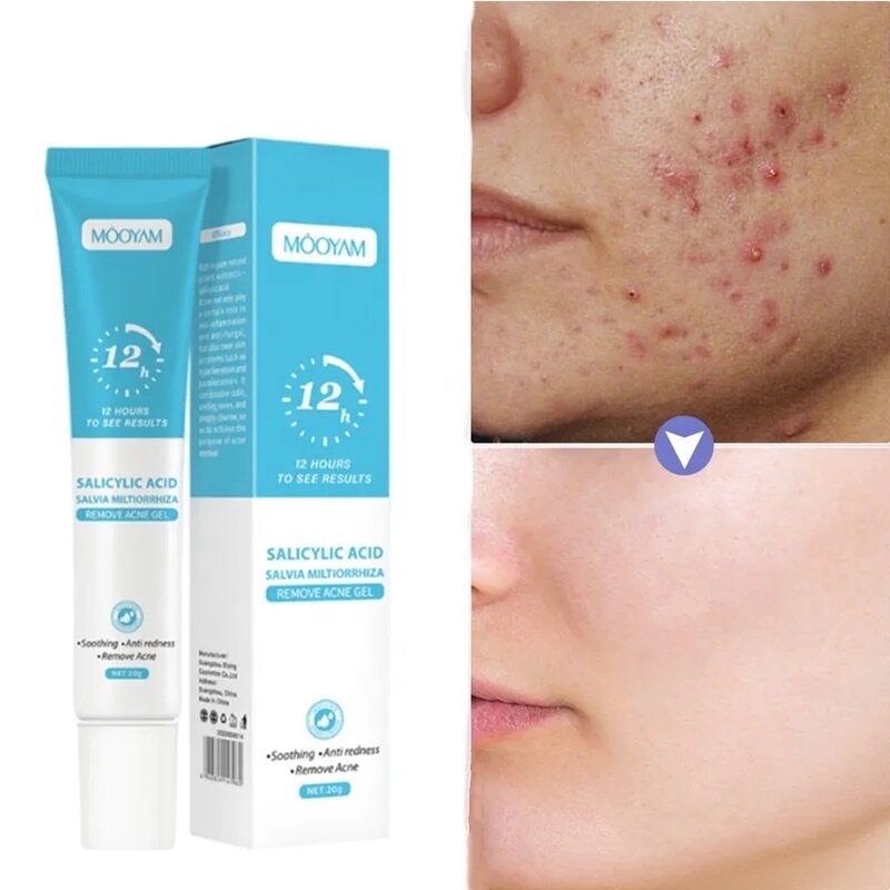 GEL ANTI-ACNE RAPIDE