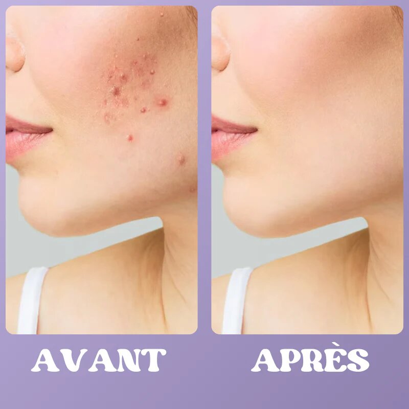 Appareil de Massage Visage LED