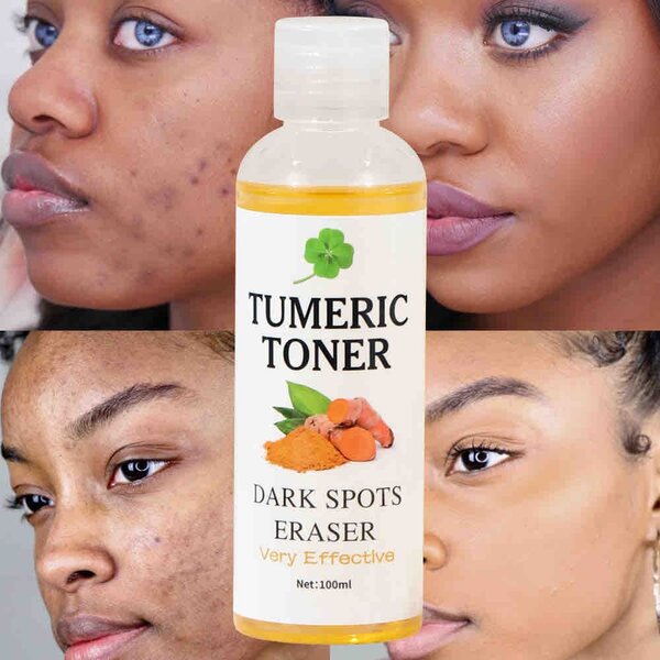 Turmeric Dark Spot Toner