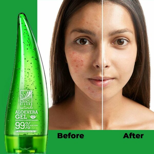 Aloe vera 99% naturel