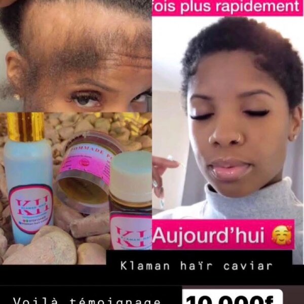 Pack Soins Capillaires Klaman