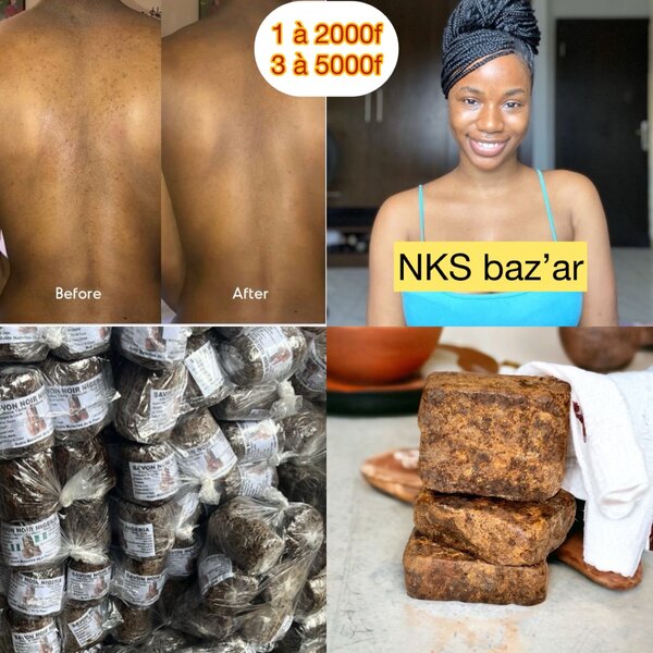 Le secret pour éliminer les boutons, gales et taches