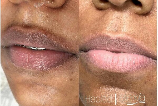 Lip Scrub for smokers and non smokers k30