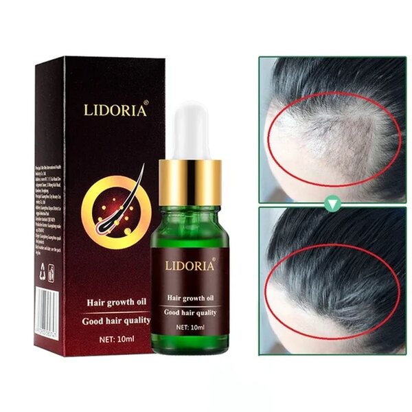 Lidoria Hair growth oil